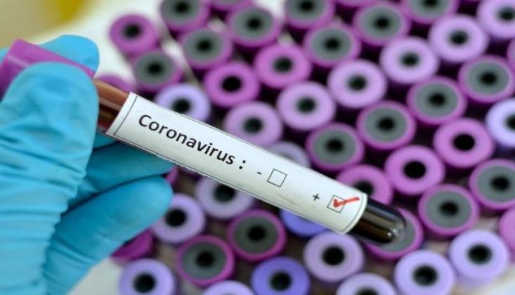 Ankara Üniversitesi 'Koronavirüse Karşı İlaç Üretmenin İlk Adımını' Attı