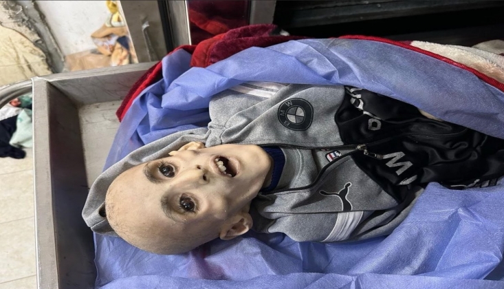 Gazze’de 66 Çocuk Açlıktan Öldü