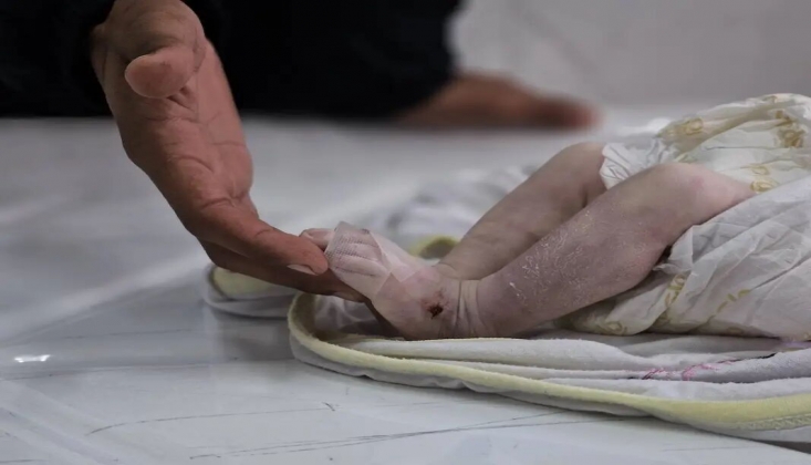Gazze'de Şehit Sayısı 54 Bine Yanaştı